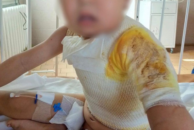 Мальчик поджег пятилетнего ребенка в Намском районе / ЯСИА   