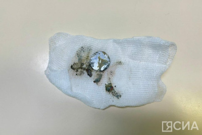 В Якутии годовалый ребенок проглотил литиевую батарейку и проходил с ней шесть дней / Саина Титова   Республика Саха (Якутия)