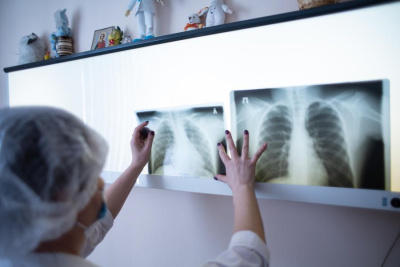 Мероприятия по борьбе с туберкулезом пройдут в Якутии в течение месяца / ЯСИА   