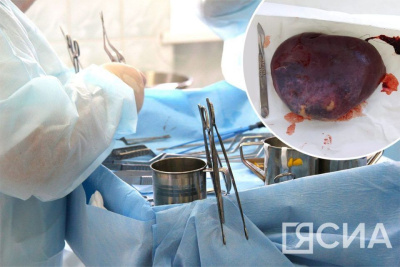 Поглотила всю селезенку: врачи в Якутии спасли 23-летнюю девушку с гигантской кистой / Саина Титова Якутск Якутск Республика Саха (Якутия)